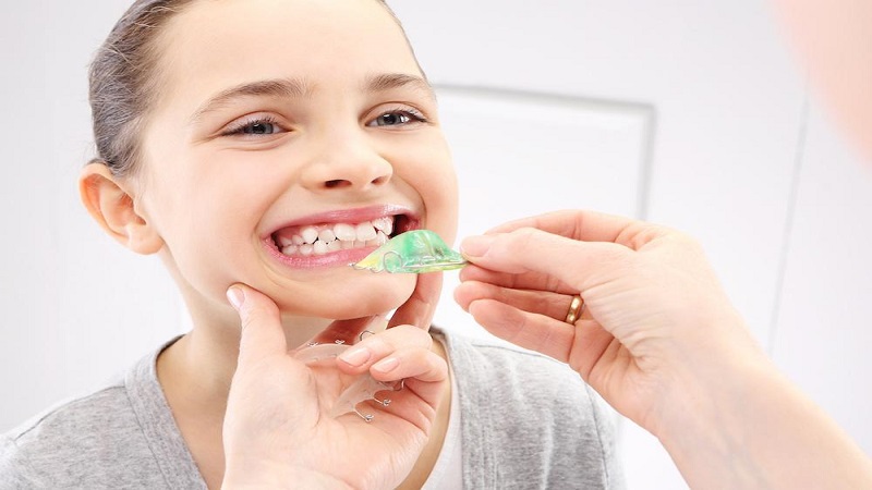 بهترین دندانپزشک کودک اصفهان |  فضا نگهدار دندان وسیله ای است که در دهان گذاشته می شود تا جای خالی که در قوس دندانی وجود دارد را باز نگه دارد و جلوی بسته شدن فضا را بگیرد.  کودکان از حدود شش سالگی به تدریج دندانهای شیری شان را از دست می دهند و به جای آنها، دندان دائمی در می آید. اما در بسیاری از مواقع، این روند طبیعی به دلایل مختلف مختل می شود و یک یا چند دندان زودتر از موعد از بین می روند و کشیده می شوند و جایشان خالی می شود. در چنین مواقعی، فضا نگهدار به جای دندان بر روی لثه گذاشته می شود تا جای خالی را برای بیرون زدن دندان دائمی نگه دارد.  فضا نگهدار دندان در کودکان      انواع فضا نگهدار انواع فضا نگهدار دندان این وسیله ممکن است از نوع ثابت باشد و به دندانها چسبانده شده باشد و یا متحرک و غیر ثابت باشد.  همچنین فضا نگهدار دندان ممکن است از جنس فلز، پلاستیک و یا ترکیبی از این دو باشد.  الف- فضا نگهدار غیر ثابت این وسیله دهانی مشابه وسیله ارتودنسی است و معمولا از جنس آکریلیک ساخته می شود. گاهی اوقات از یک دندان مصنوعی برای پر کردن جای خالی استفاده می شود. فضا نگهدار غیر ثابت را میتوانید هر زمانی که خواستید در بیاورید و دوباره بگذارید.  ب- فضا نگهدار ثابت این وسیله دهانی با چسب مخصوصی به دندانها چسبانده می شود تا تکان نخورد. فضا نگهدار ثابت چند نوع دارد:  فضا نگهدار یک طرفه: این وسیله دهانی در محیط دور جای خالی قرار می گیرد و به وسیله حلقه فلزی به یک یا دو دندان مجاور متصل می شود تا ثابت بماند. فضا نگهدار روکش و حلقه: این نوع در واقع یک روکش دندان است که روی دندان طبیعی مجاور جای خالی قرار می گیرد و یک حلقه دارد که در جای خالی مینشیند. فضا نگهدار دیستال شو: این وسیله بیشتر برای دندانهای آسیاب بزرگ (مولر) اول دائمی که هنوز بیرون نزده استفاده می شود. انتهای فلز روی لثه قرار می گیرد. فضا نگهدار زبانی یا لینگوال: این مدل برای حفظ جای خالی بیش از یک دندان استفاده می شود. معمولا این فضا نگهدار دوطرفه است و به دندانهای عقبی چسبانده می شود. اطلاعات بیشتر : دندانپزشکی کودکان  مراقبت از فضا نگهدار دندان چگونه است؟ مراقبت از فضا نگهدار دندان همانند مراقبت از دندانهای دیگر است. باید بهداشت دهان به درستی رعایت شود تا وجود فضا نگهدار باعث جمع شدن پلاک و باکتری و در نتیجه عفونت لثه یا پوسیدگی دندانهای اطراف نشود. باید هنگام مسواک زدن، با دقت فضانگهدار نیز تمیز شود تا جرم و پلاک چسبیده به آن جدا شود. با نخ دندان لا به لای دندانها و فضا نگهدار با دقت تمیز شود. خوراکی های چسبنده مصرف نشود چون ممکن است به زوایای مختلف آن بچسبد و جدا کردن آن سخت باشد. در صورت در آمدن آن، با دندانپزشک تماس بگیرید.        چه زمانی استفاده از فضانگهدارنده دندان کودک لازم است فضانگهدار دندان کودک چیست؟ فواید و عوارض فضانگهدارنده دندان کودک چیست؟ قیمت فضانگهدار دندان کودک چقدر است؟ آیا فضانگهدار دندان درد دارد؟ در این مطلب از کلینیک تخصصی دندانپزشکی سبز می‌خواهیم به همه چیز درباره فضانگهدارنده دندان کودک بپردازیم و به سوالات شما در این باره پاسخ بدهیم.  فضانگهدارنده چیست و به چه علت از آن استفاده می‌شود؟ در بسیاری از مواقع روند افتادن دندان شیری و رویش دندان های طبیعی در کودکان به دلایل مختلفی مختل می‌شود و ممکن است یک یا چند دندان زودتر از موعد بیفتد. در این هنگام با بررسی شرایط کامل بیمار از فضانگهدار استفاده می‌شود. فضانگهدار به وسیله ای می‌گویند که در دهان کودک قرار داده می‌شود که جای دندانی که از دست رفته را پر کند و از بسته شدن فضای خالی آن توسط حرکت سایر دندان ها جلوگیری کند.فضا نگهدار دندان کودک  . انواع فضانگهدارنده دندان کودک چیست؟ انواع فضانگهدارنده دندان کودکان به دو دسته تقسیم می‌شود:  فضانگهدار ثابت: این نوع فضانگهدارنده معمولا برای کودکان با سنین کمتر به کار می‌رود و در دهان آن ها به صورت ثابت قرار می‌گیرد تا از شکسته شدن یا خارج کردن آن توسط کودک جلوگیری شود. این نگهدارنده نیز انواع مختلف دارد که با توجه به موقعیت قرار گیری آن در دهان یکی از انواع آن توسط پزشک انتخاب می‌شود. فضانگهدار غیر ثابت متحرک: این نوع نگهدارنده نیز با توجه به اینکه به رسیدگی و مراقبت ویژه نیاز دارد برای کودکان در سنین بالاتر توصیه می‌شود. این نوع نگهدارنده شبیه به پلاک دندان ارتودنسی است و به راحتی از دهان خارج می‌شود و مجدد می‌توان آن‌را در دهان قرار داد.فضا نگهدارنده دندان کودک هزینه فضانگهدارنده دندان کودک چقدر است؟ از آنجایی که فضانگهدار ها اندازه و انواع مختلفی دارند و برای هر بیمار به شیوه خاصی ساخته می‌شوند، هزینه آن ها متغییر بوده و نسبت به عوامل مختلفی توسط متخصص دانپزشک اطفال تعیین می‌شود. برای دریافت اطلاعات بیشتر در این مورد ابتدا باید بیمار توسط متخصص اطفال و یا متخصص ارتودنسی معاینه شده سپس با مشورت و در نظر گرفتن همه جزئیات درمان قیمت فضانگهدار مشخص شود.  برای ویزیت، مشاوره و دریافت اطلاعات بیشتر درباره درمان ارتودنسی و سایر درمان های دندانپزشکی می‌توانید به کلینیک تخصصی دندانپزشکی سبز مراجعه کنید و درمان های دندانپزشکی خود را با بهترین متخصصین دندانپزشک انجام دهید.