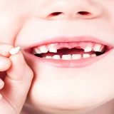 اهمیت درمان به موقع دندان های شیری | بهترین دندانپزشک کودک اصفهان